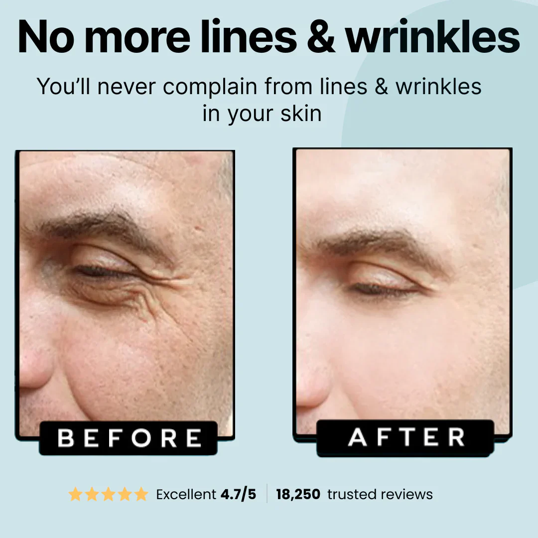 Subscription Wrinkle Defense Tallow Balm - Image 5